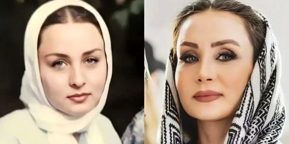 لیست عمل های زیبایی حدیث فولادوند در ۴۷ سالگی | دروغ حدیث فولادوند لو رفت ! + عکس