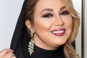چهره وحشتناک بهنوش بختیاری بعد از عمل زیبایی | بهنوش بختیاری چه بلایی سر خودش آورد